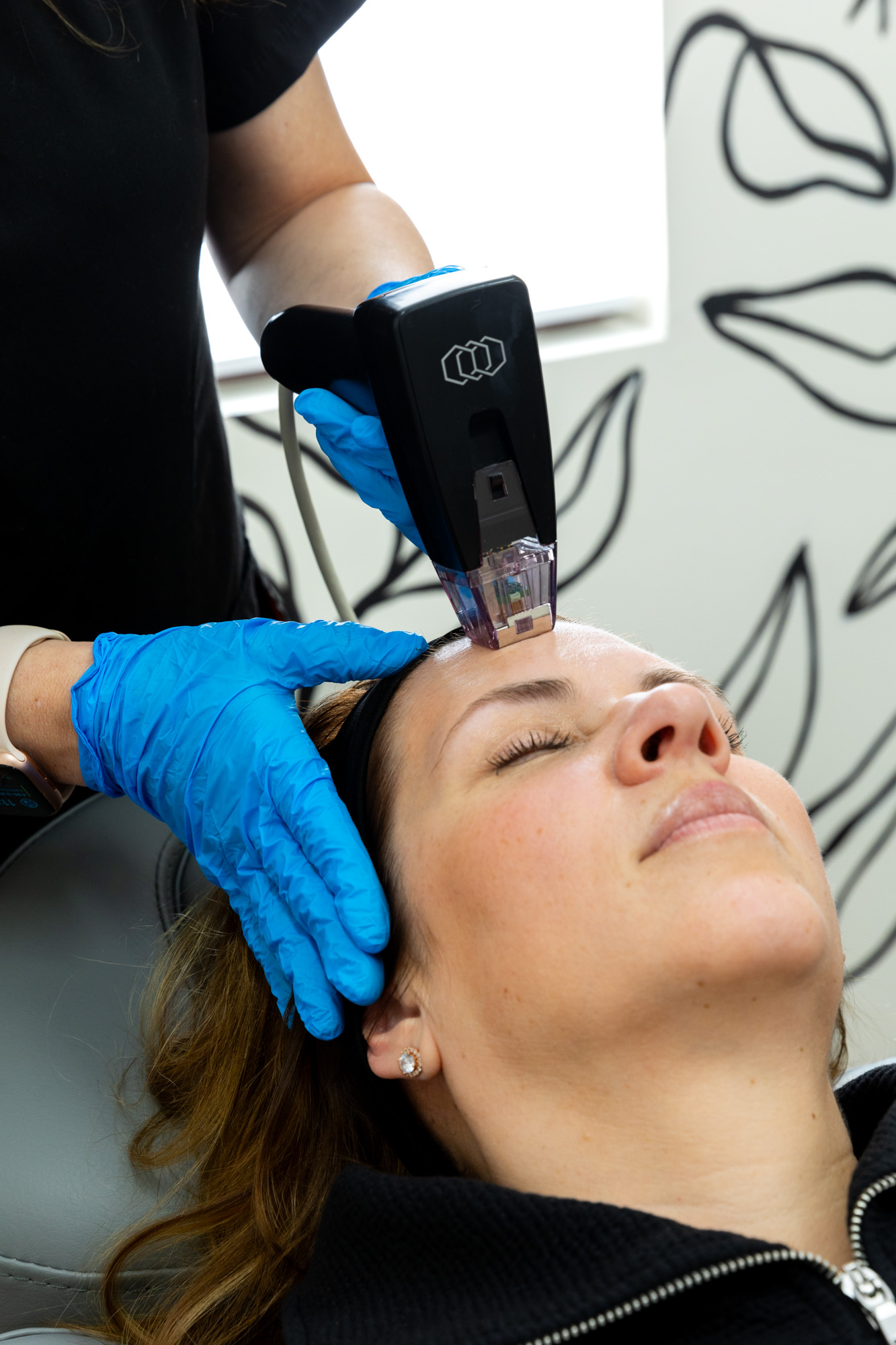 a woman is recieving a body sculpting treatment via a morpheus8 device pressed to her forehead